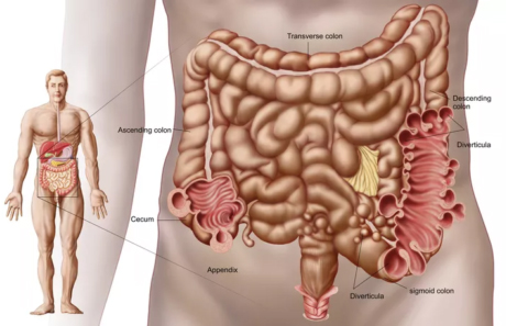 Sigmoidoscopy-pune