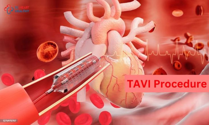 TAVI and heart problems and cures