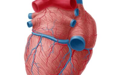 Illustration showing a blocked heart artery causing restricted blood flow to the heart