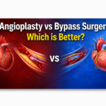 Angioplasty vs bypass surgery comparison for heart blockage treatment