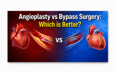 Angioplasty vs bypass surgery comparison for heart blockage treatment