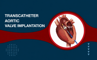 Doctor explaining TAVR non-surgical heart valve replacement procedure to a heart patient at Cardium Heart Care Clinic.