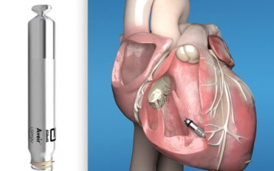 Cardiologist demonstrating a leadless pacemaker device next to a heart model illustrating modern wireless cardiac pacing technology